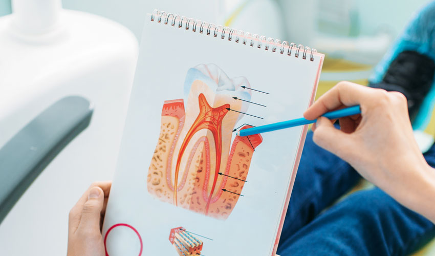 Endodonti (Kanal Tedavisi)